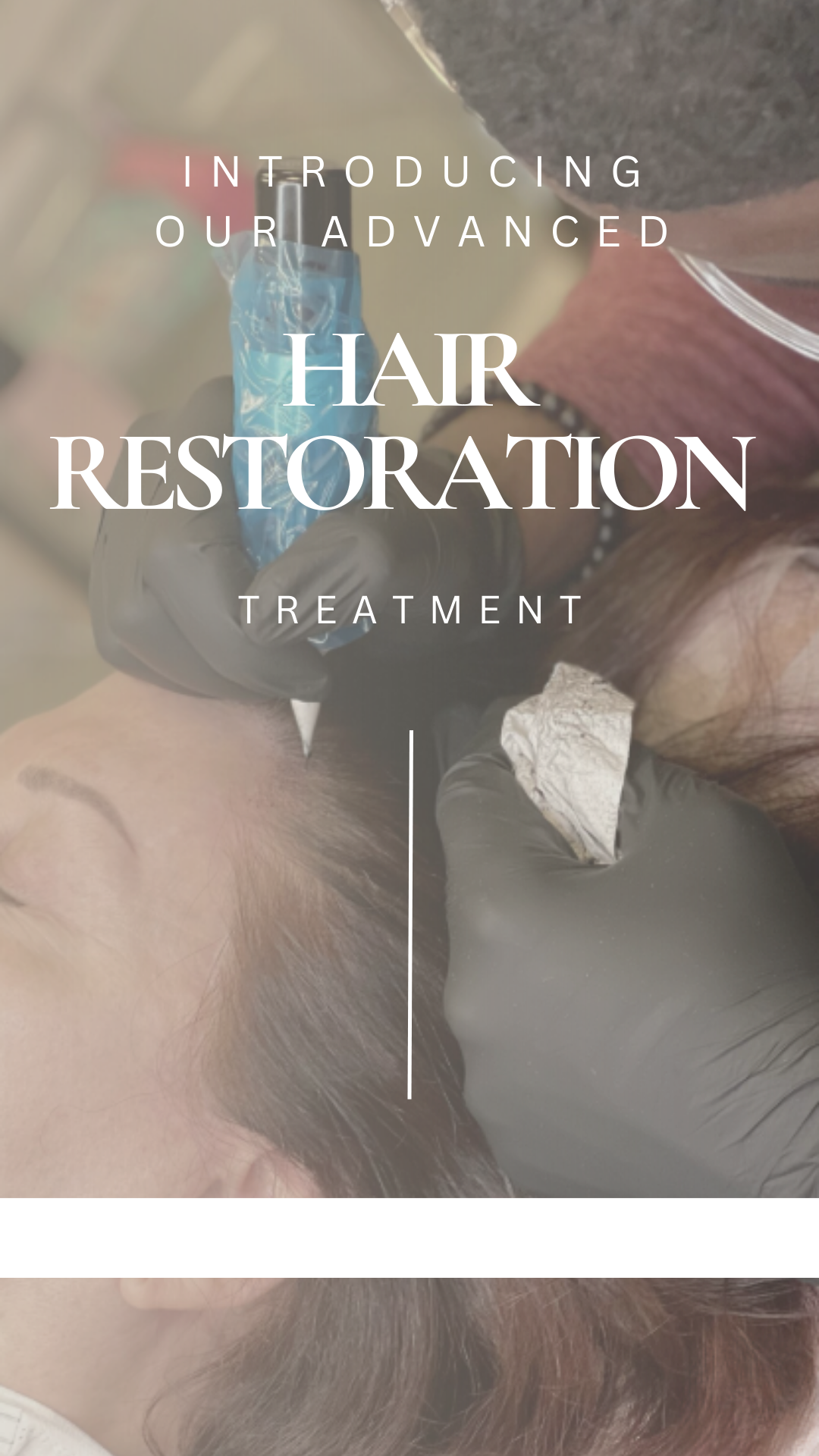 Introducing Our Advanced Hair Restoration Treatment